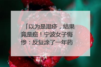 以为是湿疹，结果竟是癌！宁波女子悔惨：反复涂了一年药膏都没好！很多患者首诊都去了皮肤科